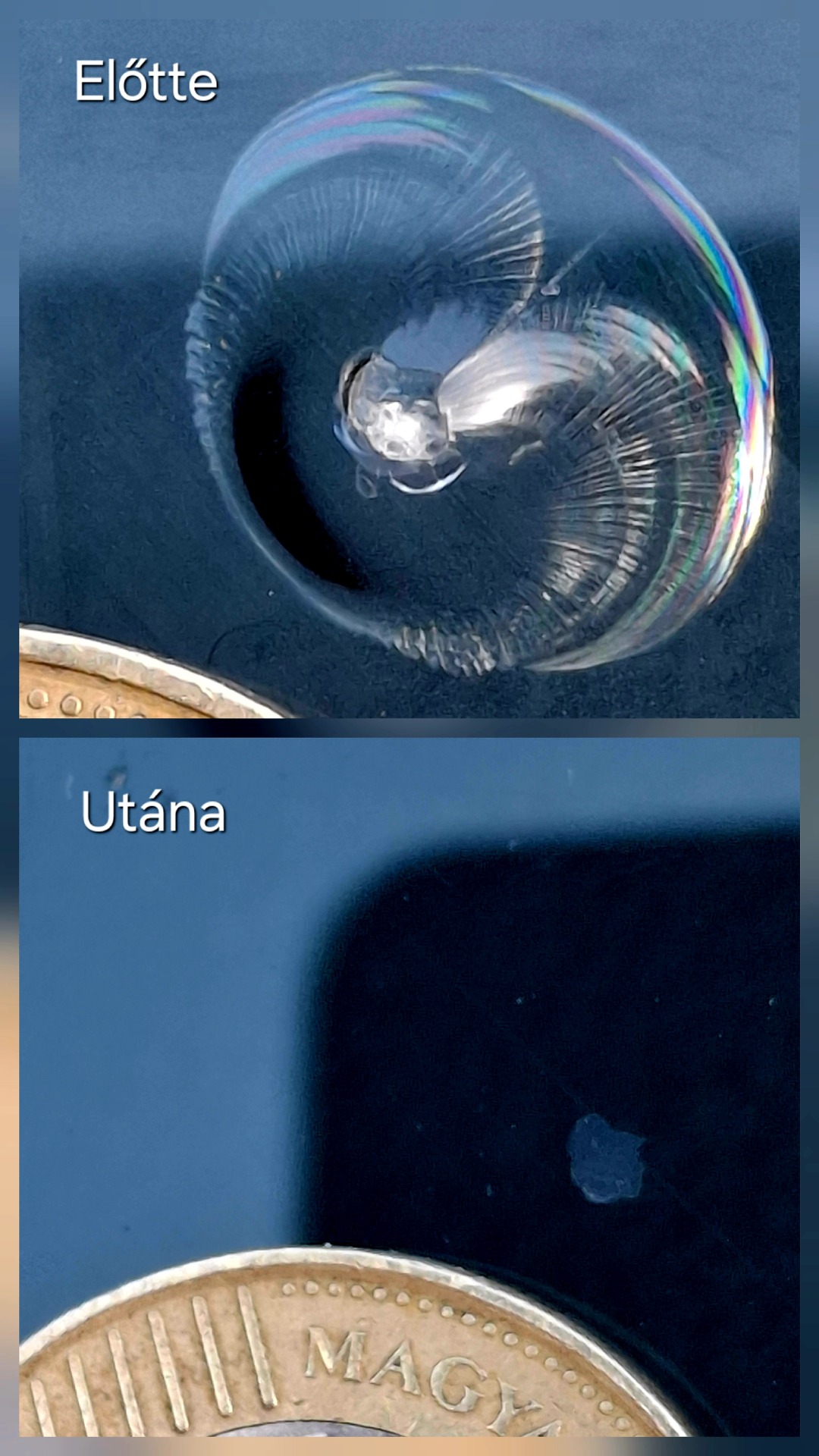 Kagylós  sérülés mikro repedésekkel